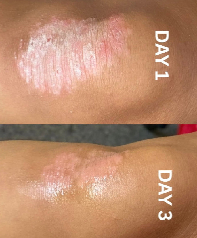 The Soothing Skin Rescue Oil